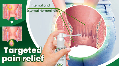 Natural Herbal Hemorrhoids Spray