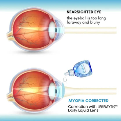 JEREMYTIS™ Daily Liquid Lens