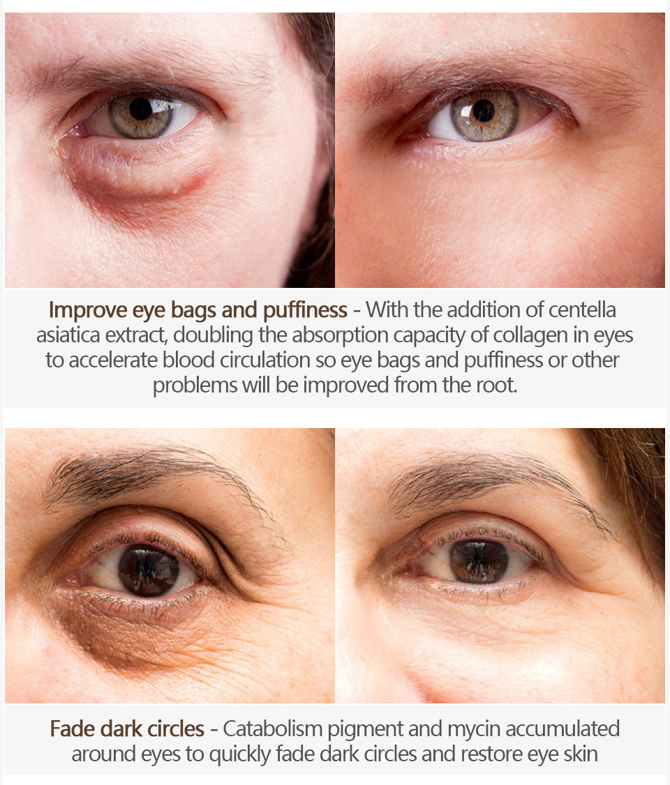 JEREMYTIS™Instant dark circles/eye wrinkles eye cream