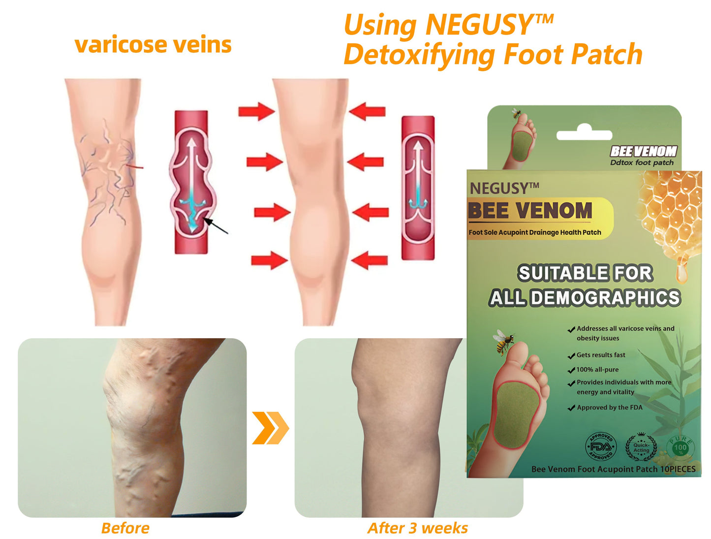 NEGUSY™ LymphTox Bee Venom Foot Patches